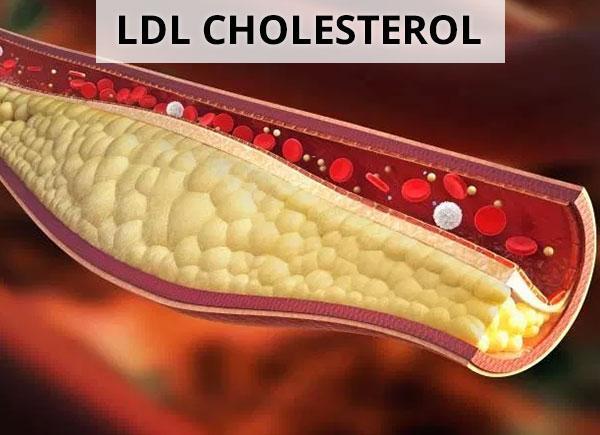 LDL và HDL